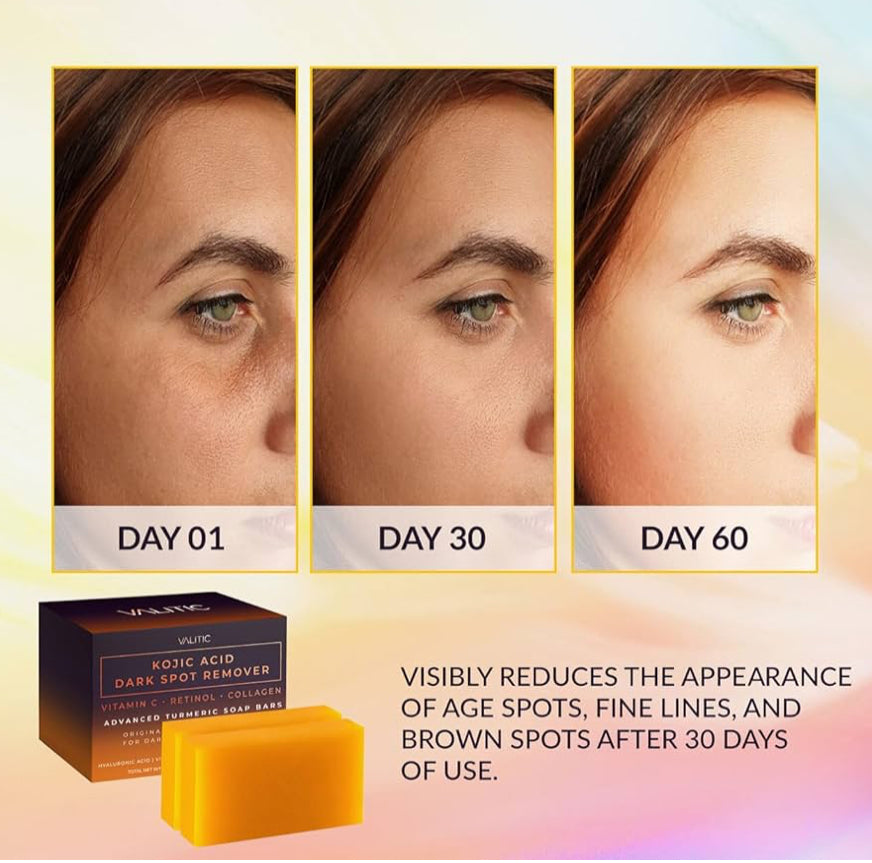VALITIC Kojic Acid Dark Spot Remover Soap Bars with Vitamin C, Retinol, Collagen lot de (2)